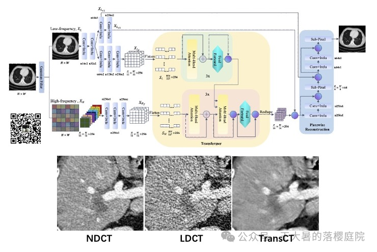 #108 CT重建的3D深度学习技术——深度学习图像重建算法分类2 #108 CT重建的3D深度学习技术——深度学习图像重建算法分类2